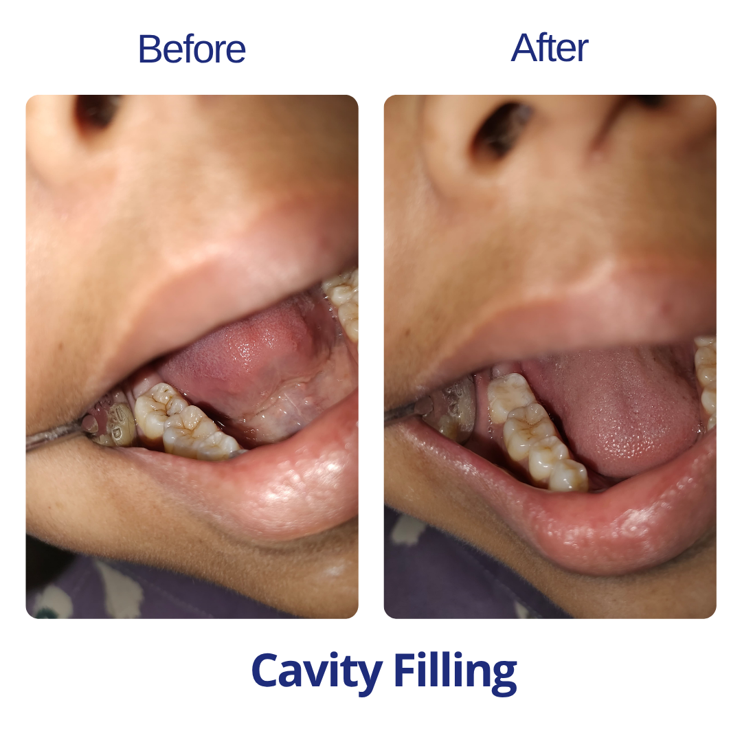 dr barish majumjer treatment (1)